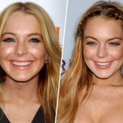 Comment les stars d’Hollywood font-elles pour avoir des dents parfaites