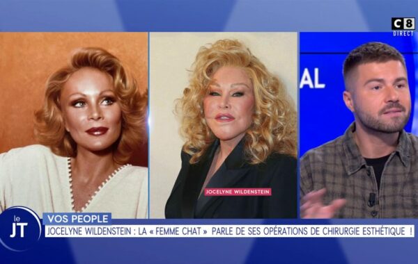 Jocelyne Wildenstein parle de ses opérations de chirurgie esthétique