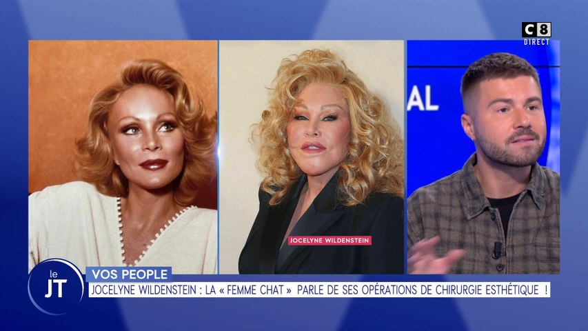 Jocelyne Wildenstein parle de ses opérations de chirurgie esthétique